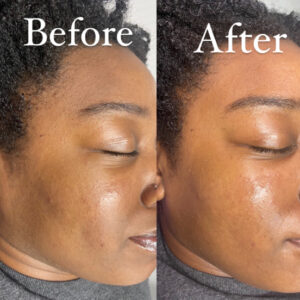 A before and after image of a dark skinned woman receiving a facial treatment.