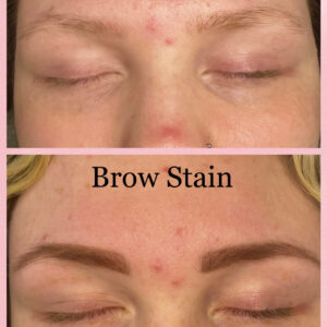 A before and after image of a woman's eyebrows receiving a brow stain treatment. The top image is before the treatment, where the woman's eyebrows are light and patchy. The bottom image is of after the treatment, in which the woman's eyebrows are now full and dark.