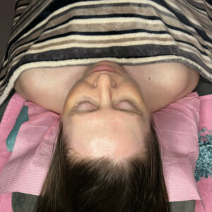 A woman laying on a spa table with a striped towel draped over her chest.